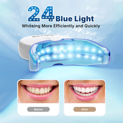 Fairywill Portable Teeth Whitening Kit, LED Blue Light and 28 White Strips for Sensitive Teeth, Rechargeable Teeth Whitener Case